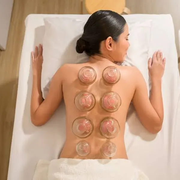 Cupping